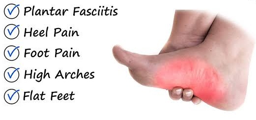 Arch Pain on Foot