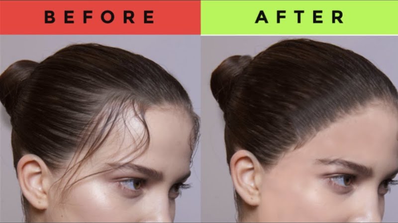 collagen hair growth before and after